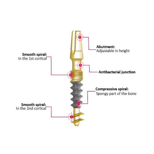 Diagram of a basal cortical implant